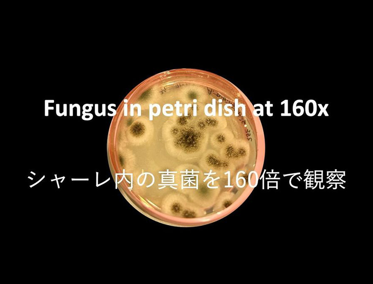 Fungus in petri dish at 160x