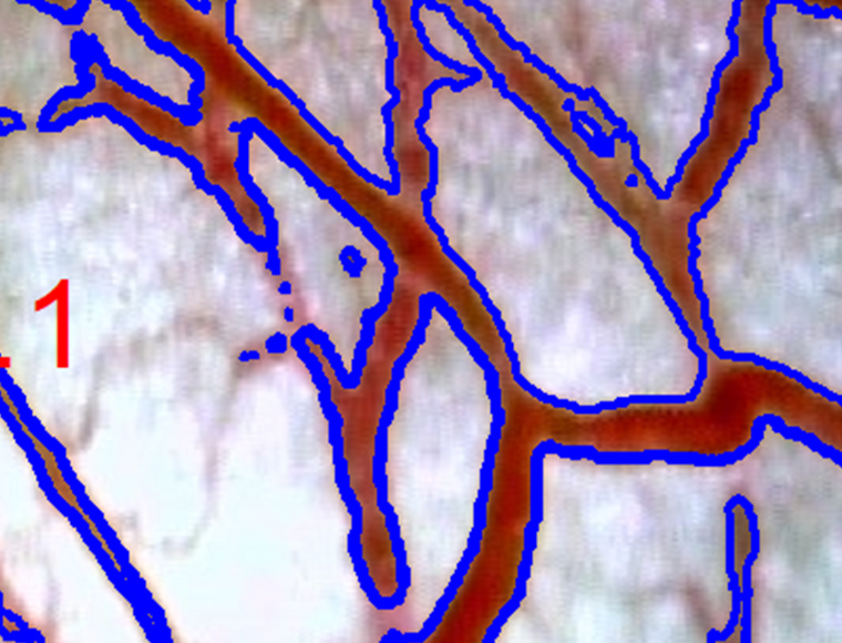 Automatic area selection(taken on the screen of GOKO Measure Plus)