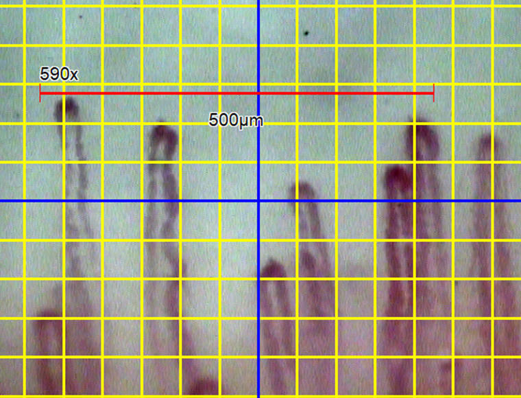 Scale bar(taken on the screen of GOKO Measure Plus)
