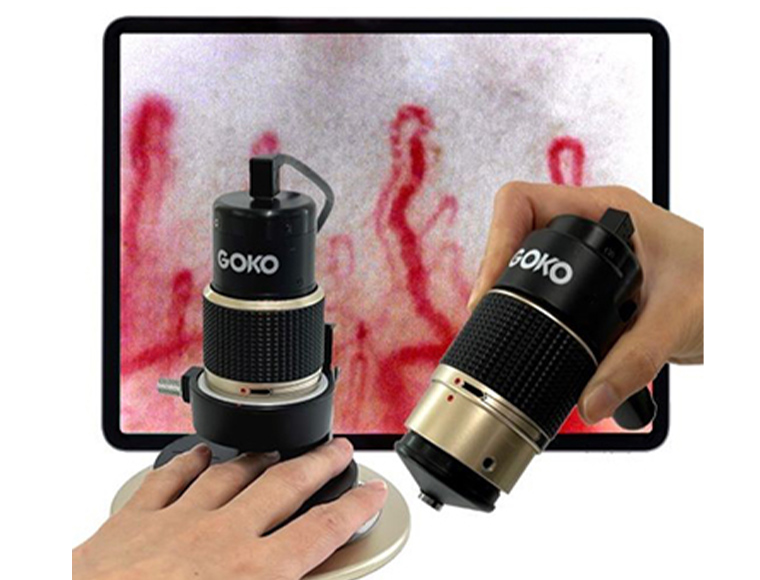 Capillaries projected on a tablet with GOKO Bscan-ZD product, a whole body capillary scope