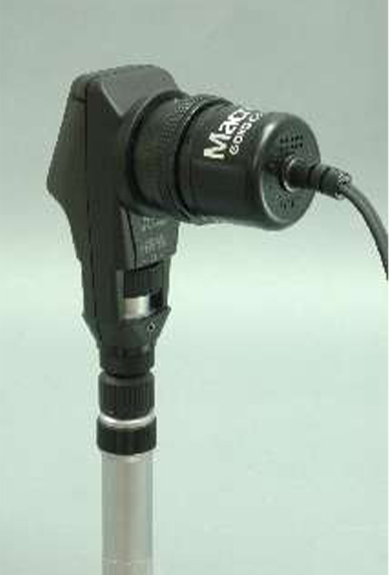 retinoscope