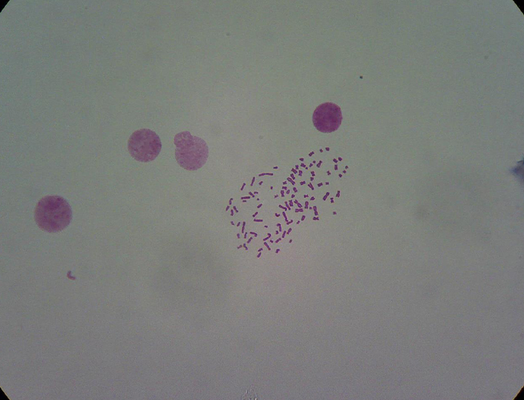 Chromosome