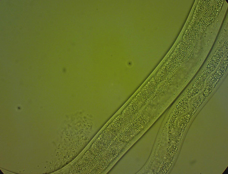 Bright-field image and fluorescence observation by fluorescence microscope