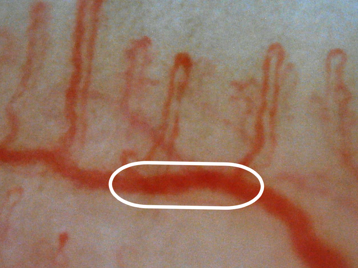 Nailfold capillaries (at higher magnification) 720X, upgraded color reproducibility New version (Ver.1.1)