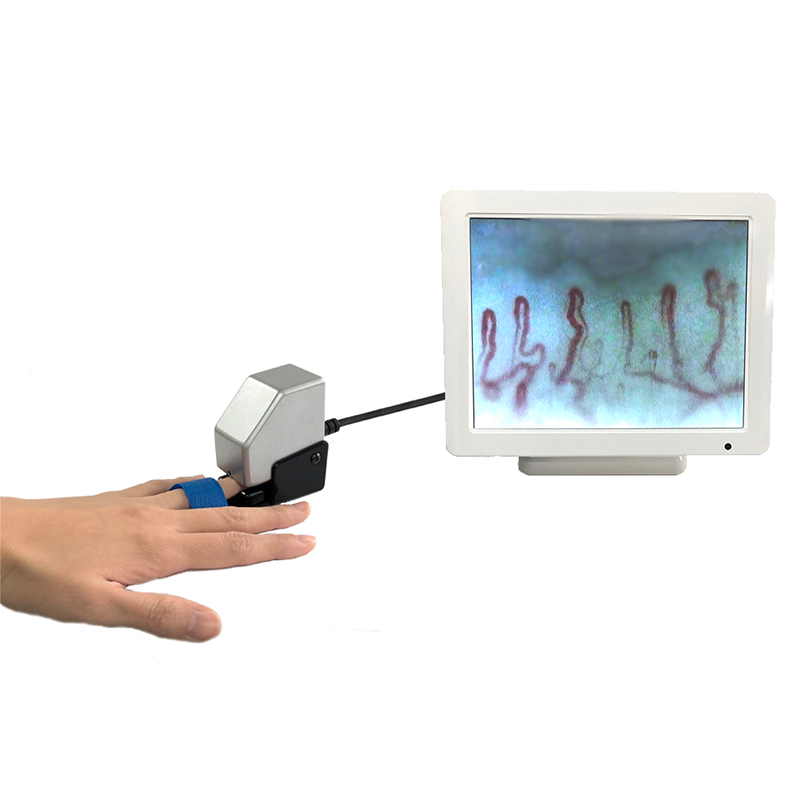 Capillaroscope tailored for long-term monitoring