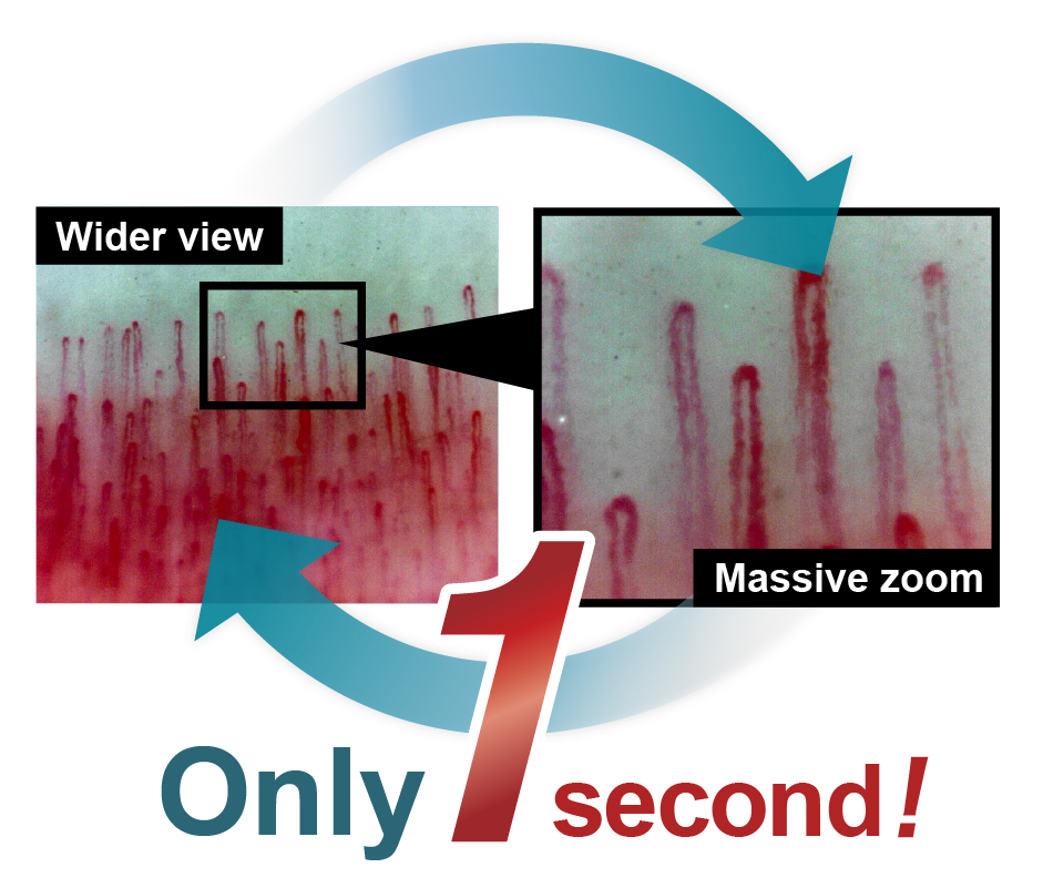 Capillary scope - you can switch between 'whole image' and 'super magnification' in only one second.