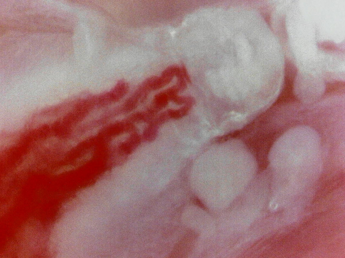 Tongue capillaries (Massive zoom)