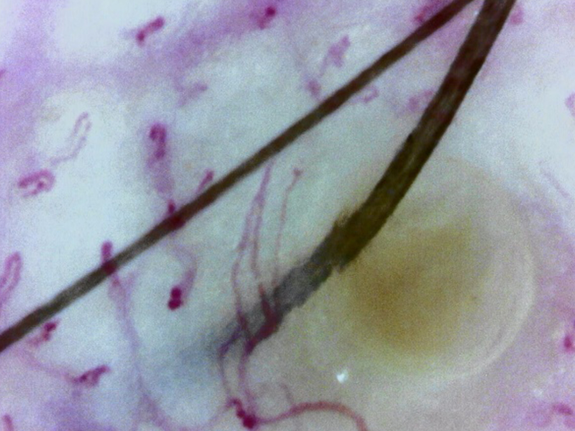Scalp capillaries (Massive zoom)