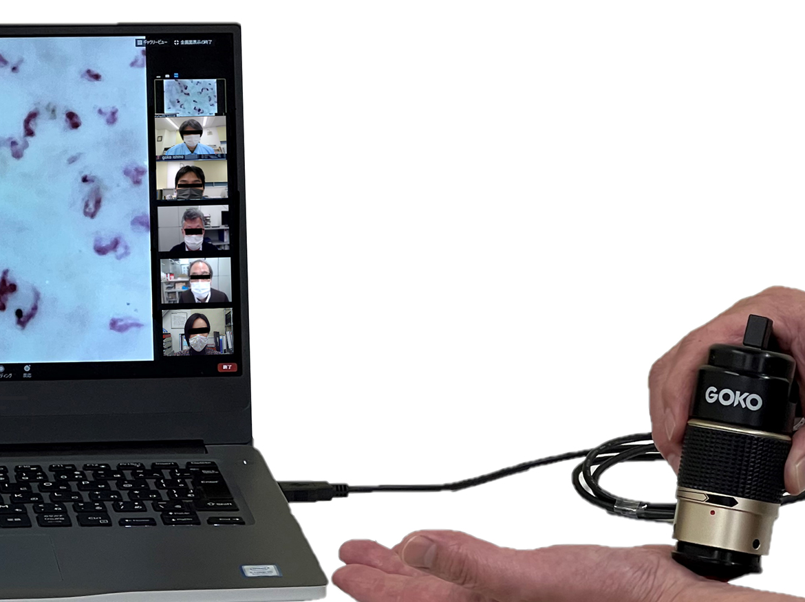 Real-time blood flow images shared remotely via Zoom application