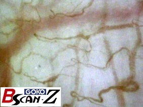 Labial Microvascular(560×)