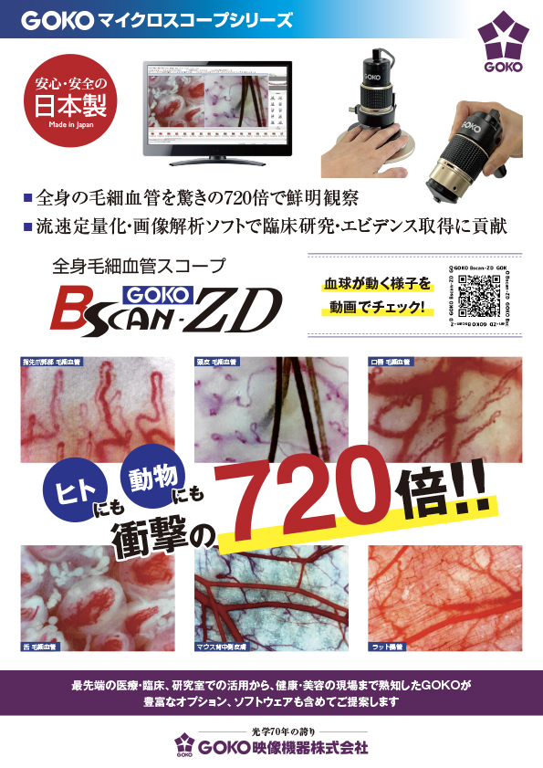 全身毛細血管血流スコープ GOKO Bscan-ZD（USBモデル）