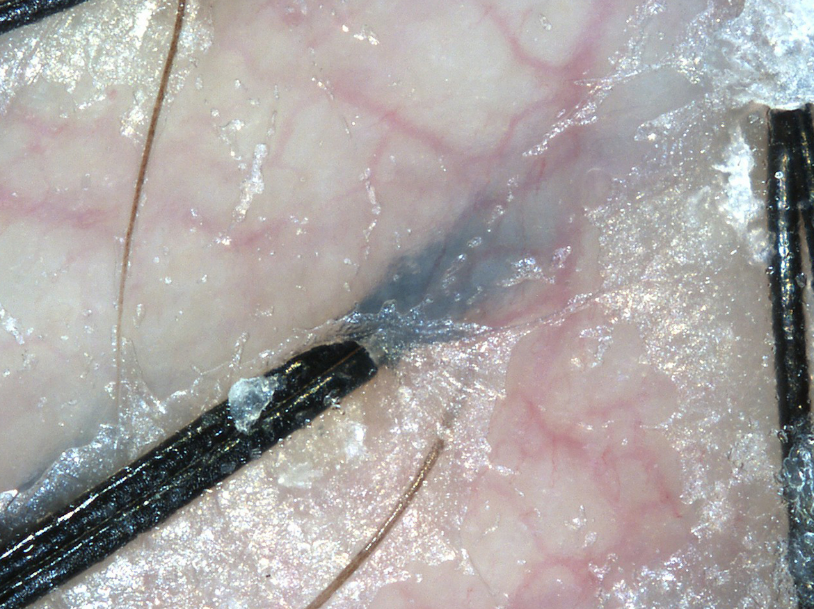 Scalp - Hair roots and capillaries