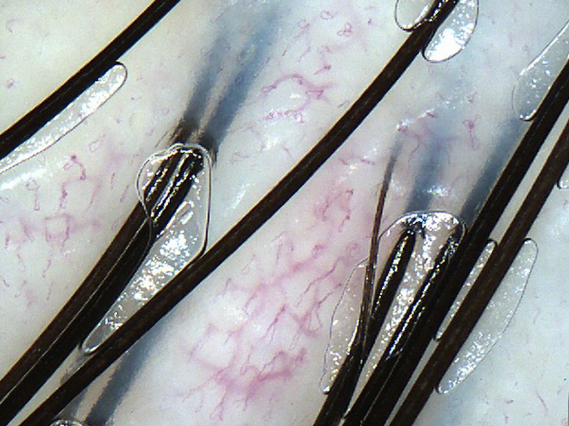 Scalp - Hair roots and capillaries
