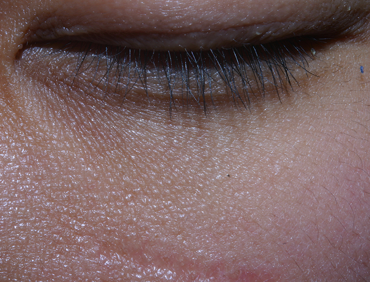 skin
